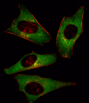 PI3KCD Antibody (N-term)
