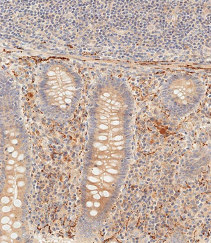 PI3KCD Antibody (C-term)
