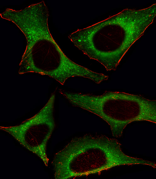 PI3KCD Antibody (C-term)