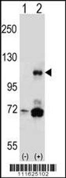 PIK3CB Antibody (N-term S139)