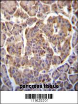 PIK3CB Antibody (N-term S139)