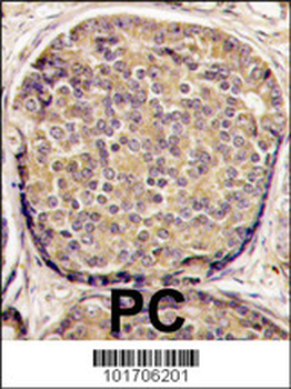 PI3KCB Antibody (C-term)