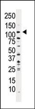 PI3KC3 Antibody (N-term)