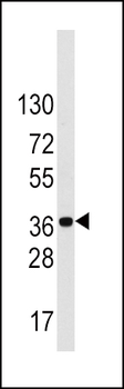 ARH (LDLRAP1) Antibody (C-term)