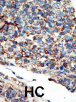 PI3KC2G Antibody (N-term)