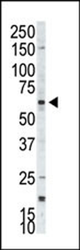 p70 S6Kbeta Antibody (C-term)