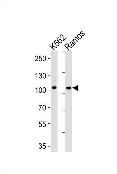 MLK4 Antibody (N-term)