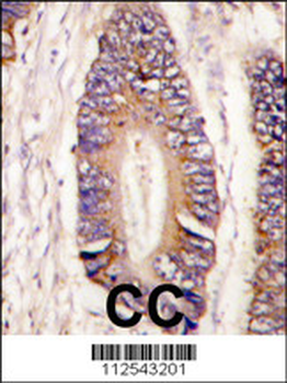 MLK4 Antibody (N-term)