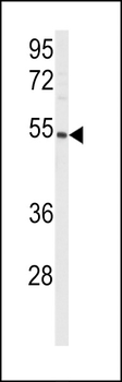 CYP8A1 Antibody (N-term)