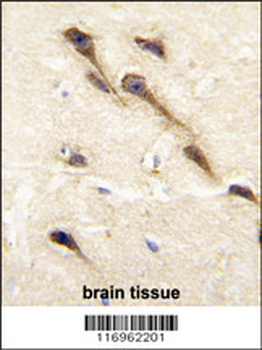 CYP26B1 Antibody (C-term)