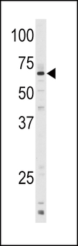 CYP1A1 Antibody (C-term)