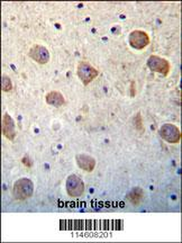 UTS2 Antibody (N-term)