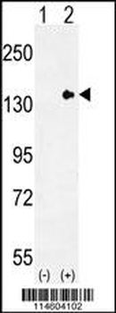 TLL2 Antibody (N-term)