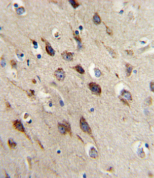 BDNF Antibody (C-term)