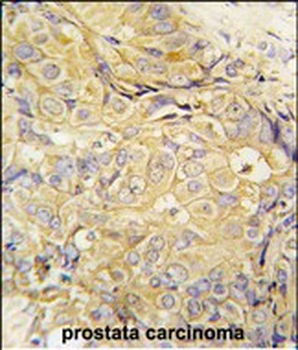 FGF10 Antibody (C-term)
