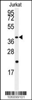 CASP9 Antibody (S196)