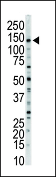 MLCK Antibody (N-term)