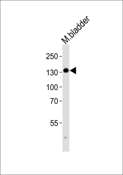 MLCK Antibody (N-term)