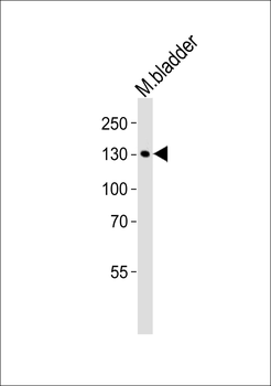 MLCK Antibody (N-term)