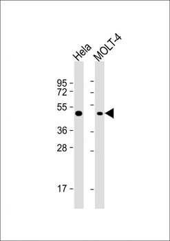 MAP2K2 Antibody (T394)