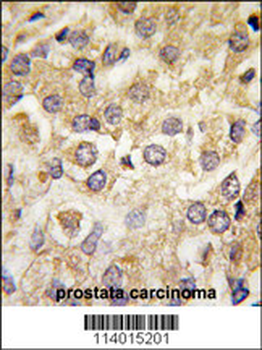 MAP2K2 Antibody (T394)