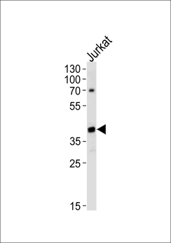 MAP2K1 Antibody (T291)