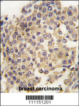 MAP2K1 Antibody (T291)