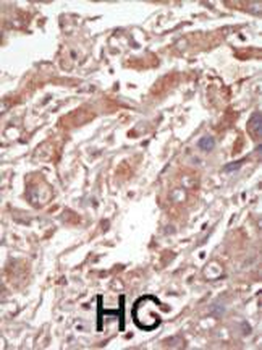 LOK Antibody (C-term E707)