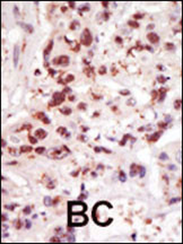 COT (MAP3K8/MEKK8) Antibody (C-term)