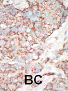 YSK Antibody (C-term)