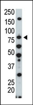 HUNK Antibody (C-term)