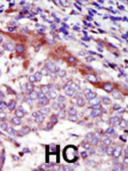 HUNK Antibody (C-term)