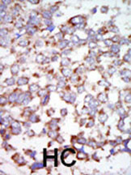 TAK1 Antibody (C-term)