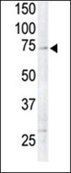 RSK4 Antibody (N-term)