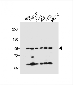 PKN beta Antibody (C-term)