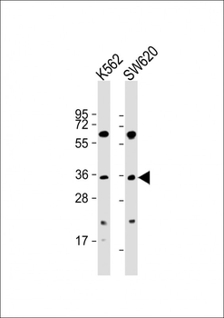 PIM2 Antibody (C-term)