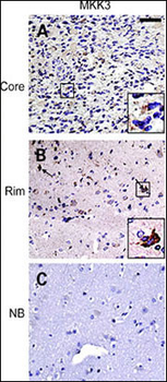 MEK3 (MAP2K3) Antibody (N-term)