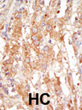 MEKK6 Antibody (C-term)