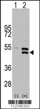 MAP2K5 Antibody (S149)