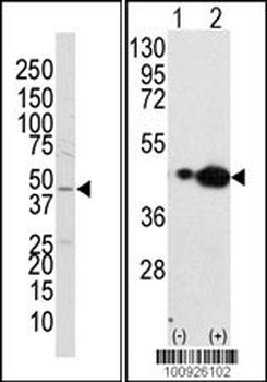 MEK2 Antibody (N-term)