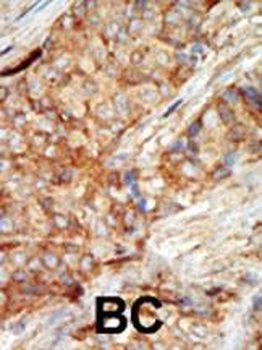 GCK Antibody (N-term)