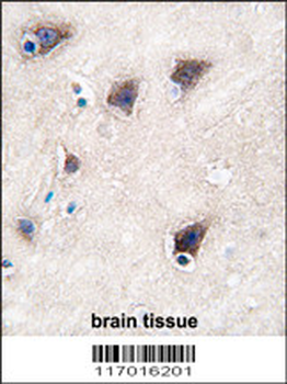 CYP2R1 Antibody (C-term)