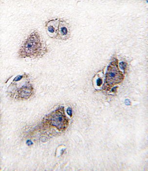 CYP26C1 Antibody (C-term)