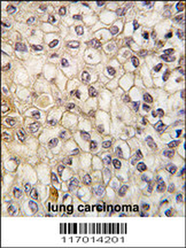 CYP2F1 Antibody (C-term)