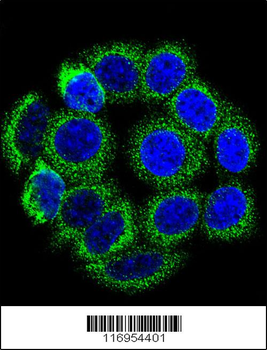 CYP21A2 Antibody (Center)