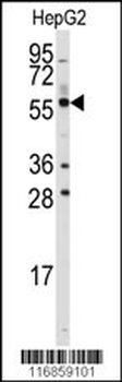 ALDH4A1 Antibody (C-term)