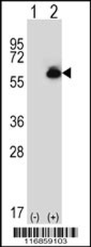 ALDH4A1 Antibody (C-term)