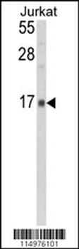 GMFG Antibody (N-term)