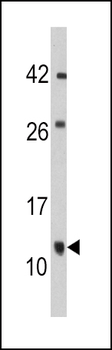 FKBP1B Antibody (N-term E6)