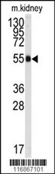 ALDH9A1 Antibody (C-term)